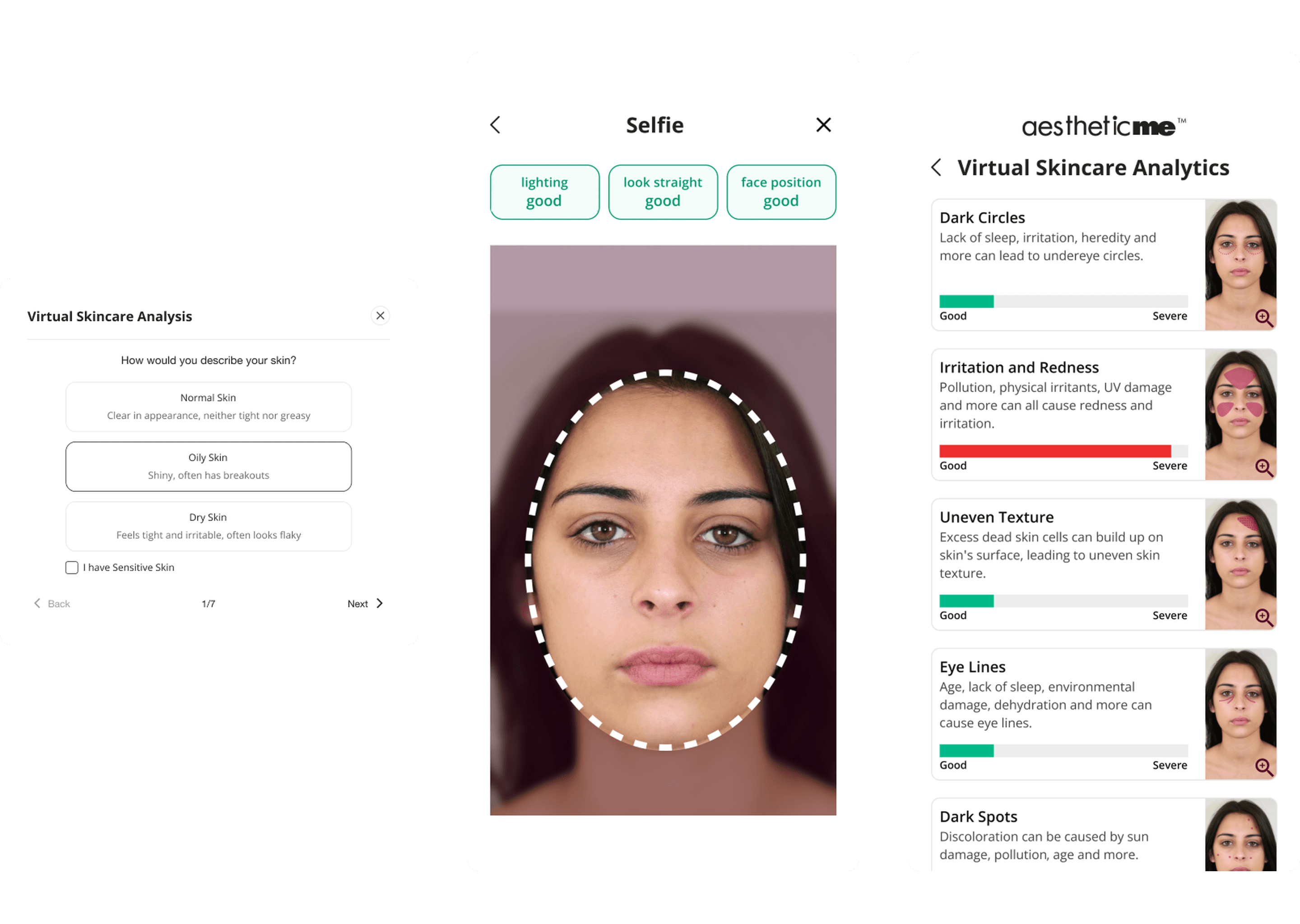 Aesthetic Me skin analysis: a seven-question skin quiz on web, a guided selfie with lighting, angle and position checks, and the results screen rating each skin concern from good to severe.